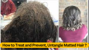 Matted Hair: How to Treat and Prevent, Untangle Matted Hair ?